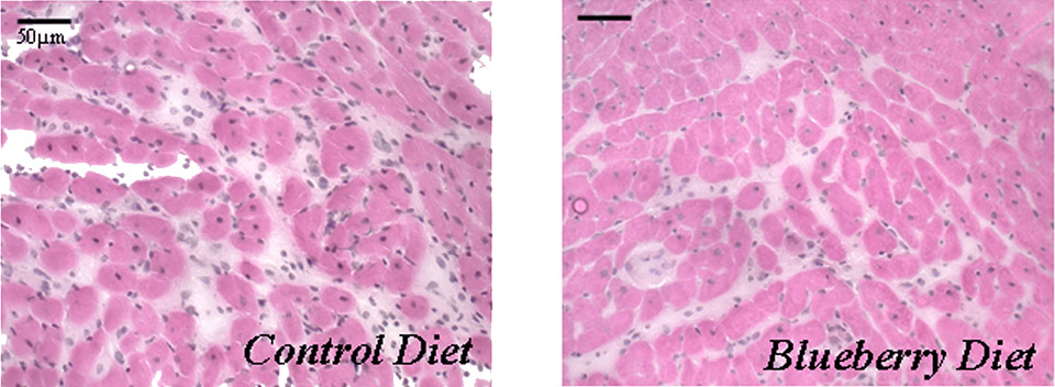 心筋の拡大写真